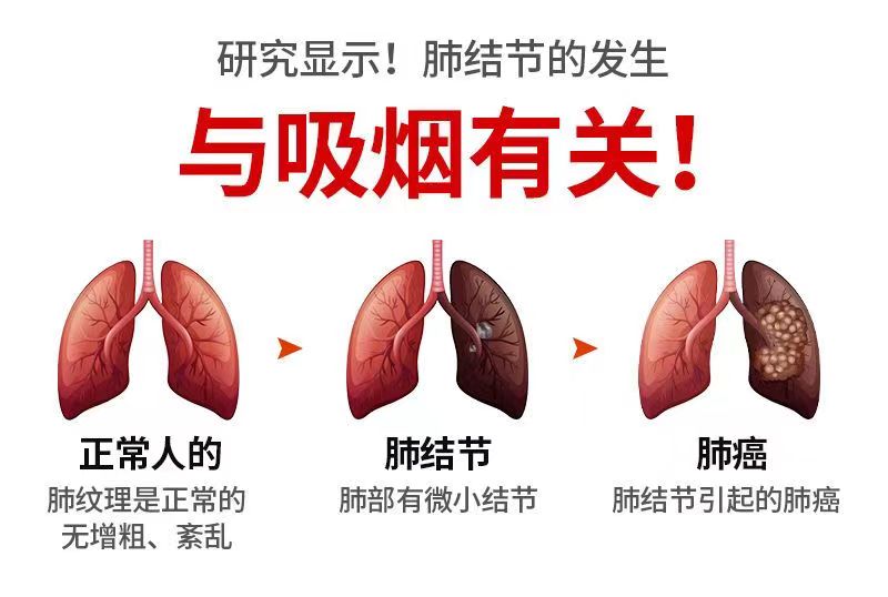 肺槲皮素7.jpg