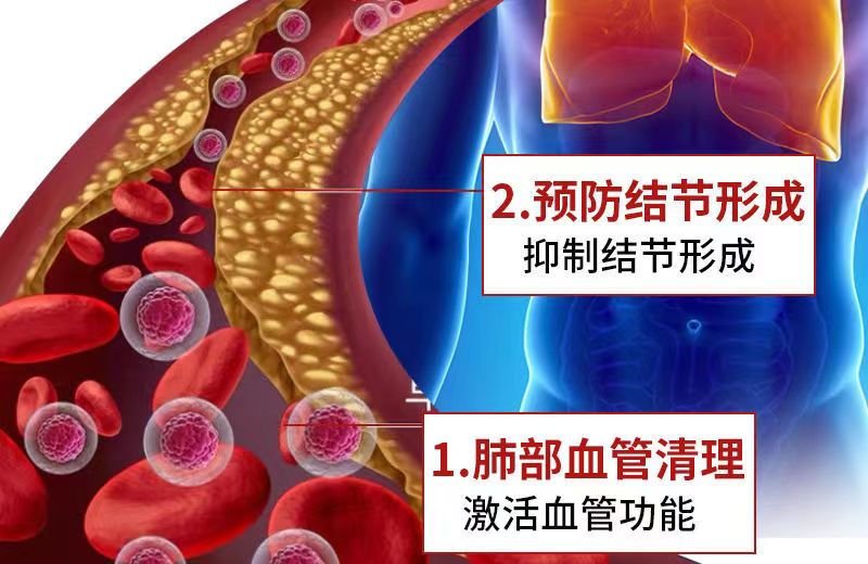 肺槲皮素14.jpg